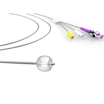 Triple-Lumen Biliary Stone Retrieval Balloon